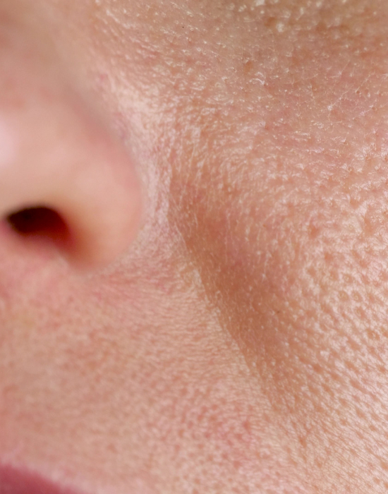 Skin Texture