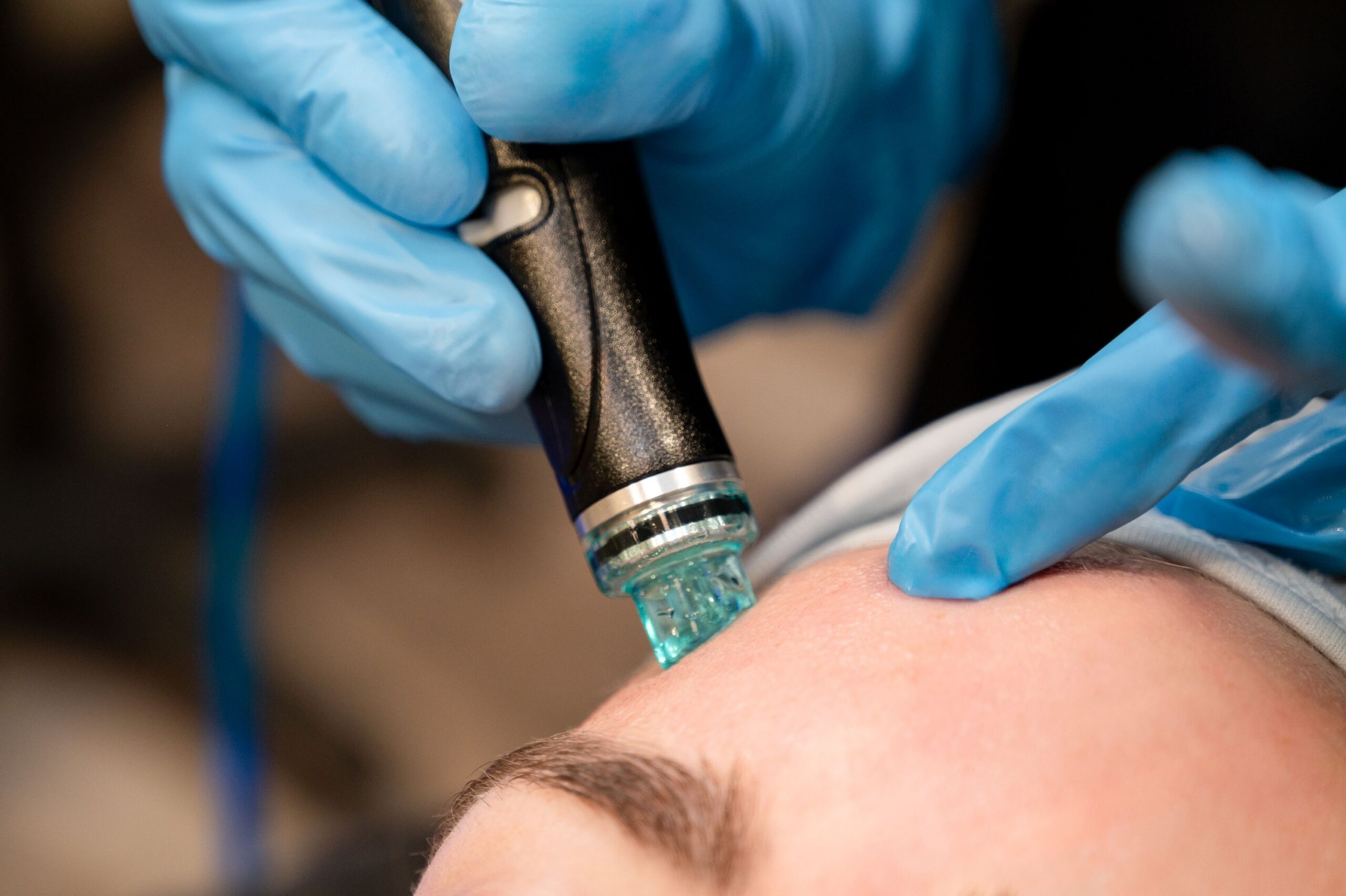 How to Prepare for HydraFacial